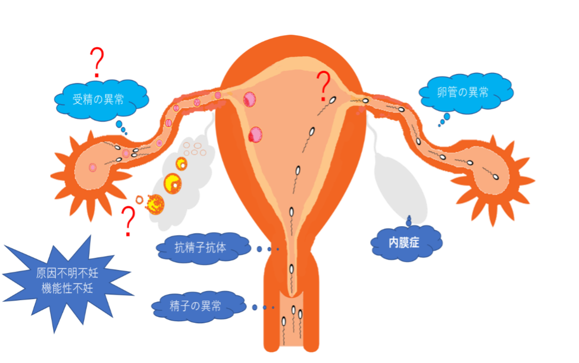 原因 不明 不妊 どうすれば